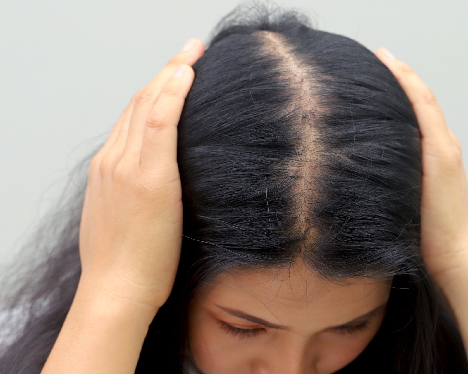 Sem brilho e ressecado